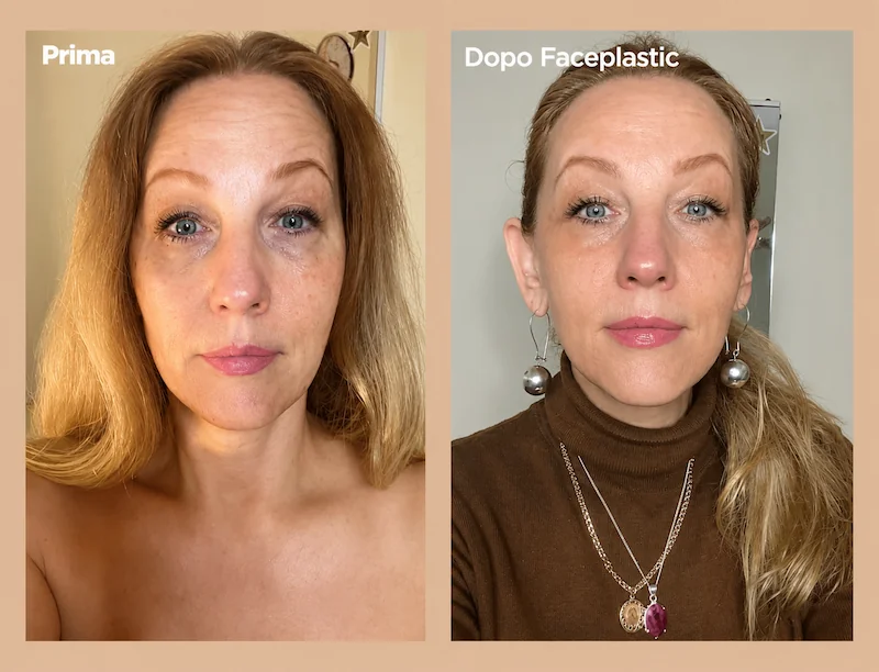 Face plastic